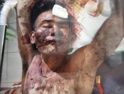 Warga Pendatang Diduga Gangguan Jiwa Mengamuk di Kuta, Diamuk Massa hingga Sekarat*